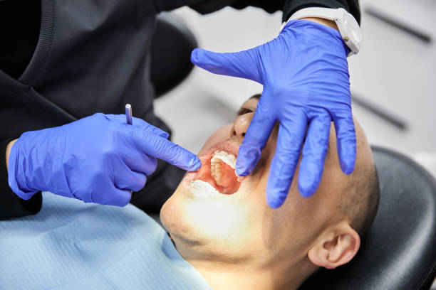 Best Emergency Tooth Extraction in Point Venture, TX