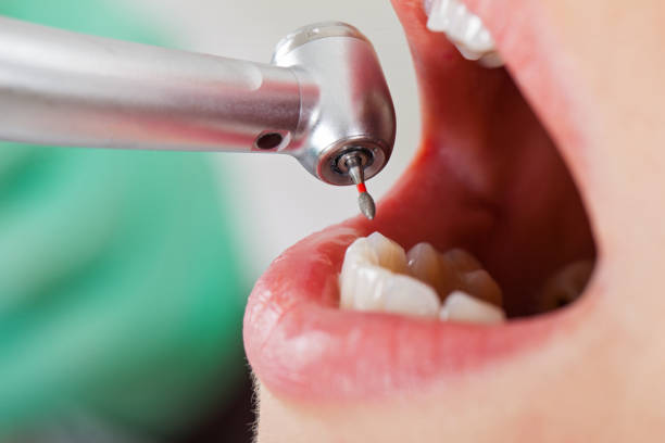 Best Same-Day Emergency Dental Services in Point Venture, TX